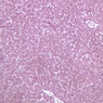 B32, Liver, 10x (Reticulin)