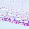 A75, Trachea, 20x (H&E)