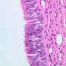 A76, Trachea, 40x (H&E)