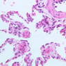 A74, Lung, 40x (H&E)