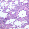 A74, Lung, 10x (H&E)
