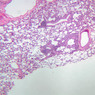 A74, Lung, 2.5x (H&E)