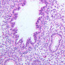 A13, Lung (Fetal), 20x (H&E)