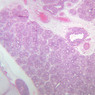 A13, Lung (Fetal), 2.5x (H&E)