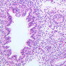 A13, Lung (Fetal), 20x (H&E)