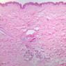 A48, Abdominal Skin, 2.5x (H&E)