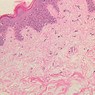 A48, Abdominal Skin, 20x (H&E)
