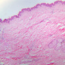 A48, Abdominal Skin, 2.5x (H&E)