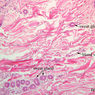 A48, Abdominal Skin, 10x Labeled (H&E)
