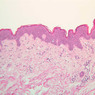 A48, Abdominal Skin, 10x (H&E)