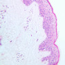 A48, Abdominal Skin (Dark), 20x (H&E)
