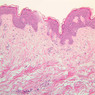 A48, Abdominal Skin, 10x (H&E)