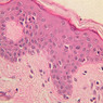 A48, Abdominal Skin, 40x (H&E)