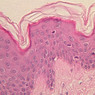 A48, Abdominal Skin, 40x (H&E)