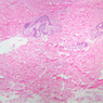 A48, Abdominal Skin, 2.5x (H&E)